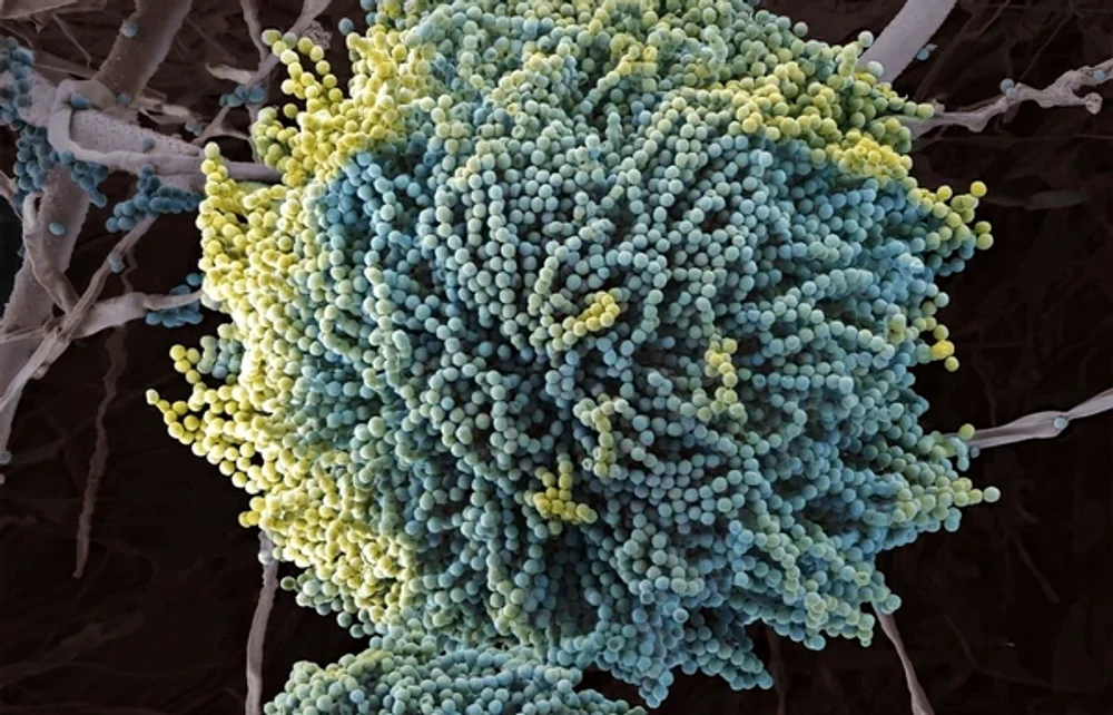 O ciupercă periculoasă pune în pericol omenirea: „Realitatea este deja destul de înfricoșătoare”